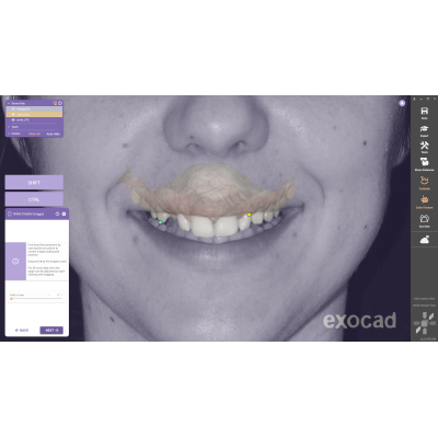 Exocad DentalCAD [Flex] [Standalone]