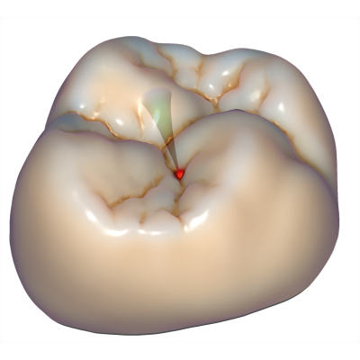 Exocad DentalCAD [Flex] [Standalone]