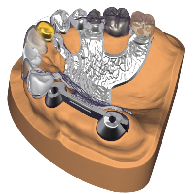 Exocad DentalCAD [Flex] [Standalone]