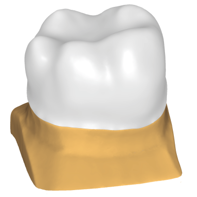 Exocad DentalCAD [Flex] [Standalone]