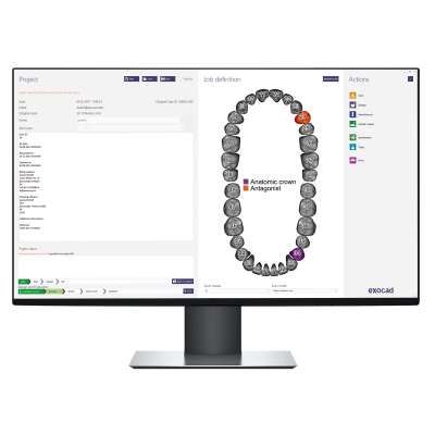 Exocad DentalCAD [Flex] [Standalone]