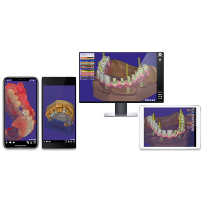 Exocad DentalCAD [Flex] [Standalone]