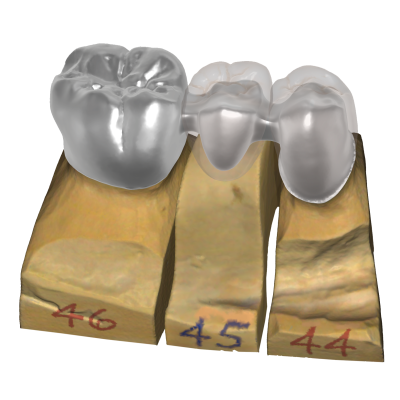 Exocad DentalCAD [Flex] [Standalone]