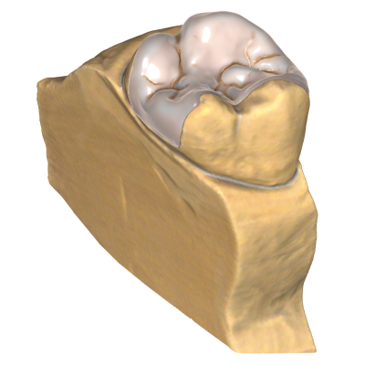 Exocad DentalCAD [Flex] [Standalone]