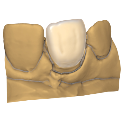 Exocad DentalCAD [Flex] [Standalone]