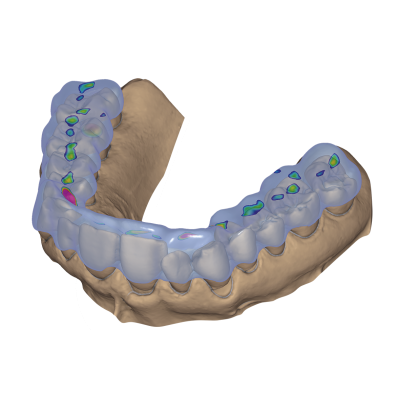 Exocad DentalCAD [Flex] [Standalone]