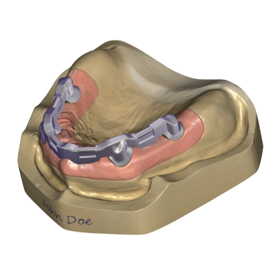 Exocad DentalCAD [Flex] [Standalone]