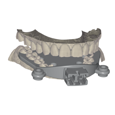 Exocad DentalCAD [Flex]