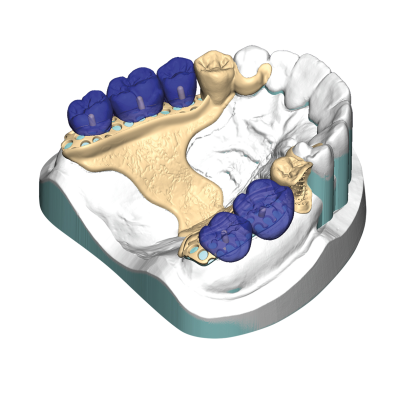 Exocad DentalCAD [Flex] [Standalone]