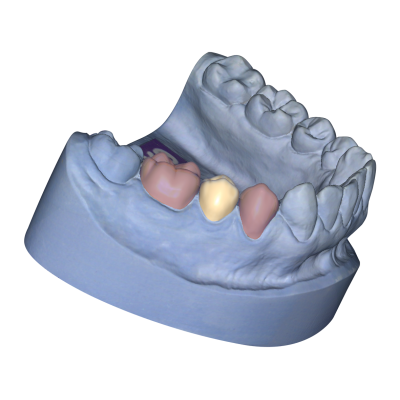 Exocad DentalCAD [Flex] [Standalone]