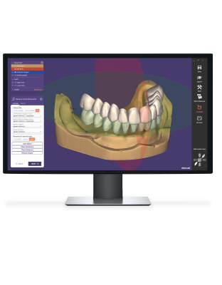 Exocad DentalCAD [Flex]