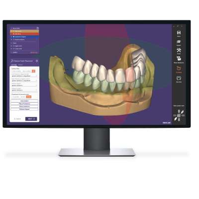 Exocad DentalCAD [Flex]