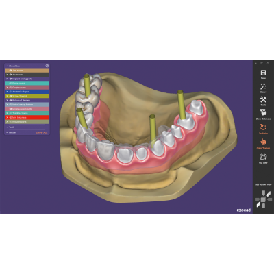 Exocad DentalCAD [Flex] [Standalone]