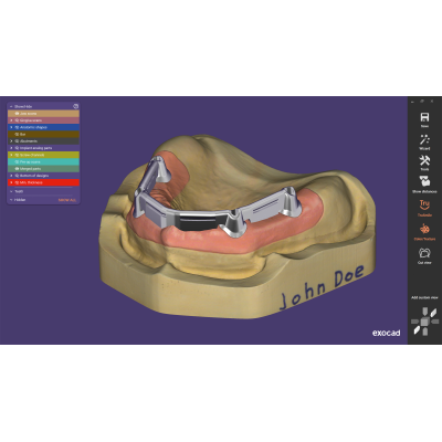 Exocad DentalCAD [Flex]