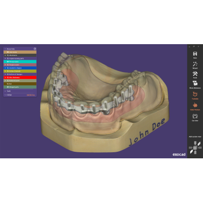 Exocad DentalCAD [Flex]