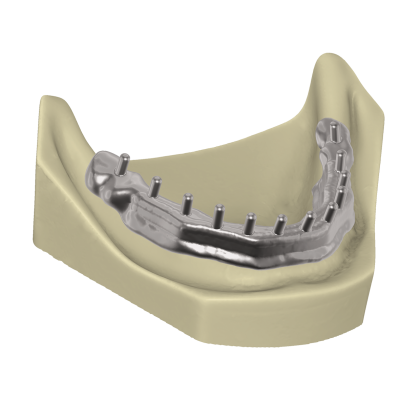 Exocad DentalCAD [Flex] [Standalone]