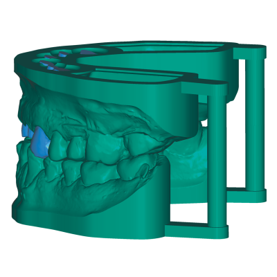 Exocad DentalCAD [Flex] [Standalone]