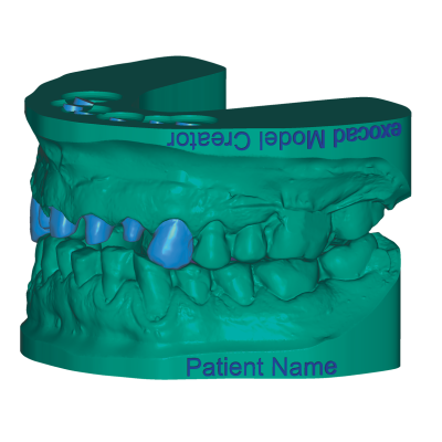 Exocad DentalCAD [Flex] [Standalone]