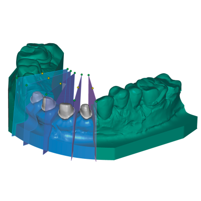 Exocad DentalCAD [Flex] [Standalone]