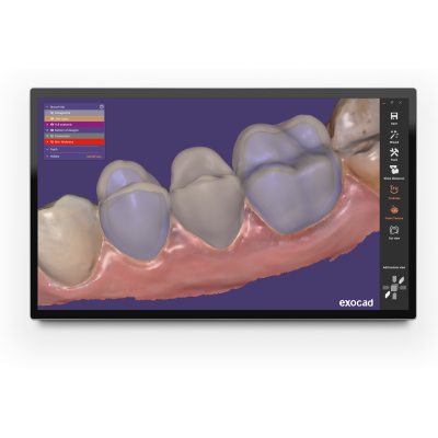 Exocad DentalCAD [Flex]