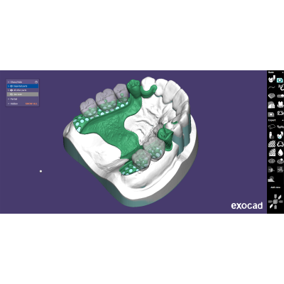 Exocad DentalCAD [Flex] [Standalone]