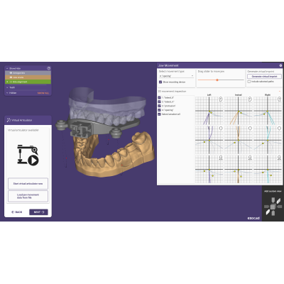 Exocad DentalCAD [Flex] [Standalone]