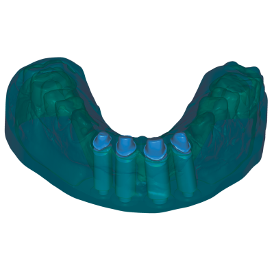 Exocad DentalCAD [Flex] [Standalone]