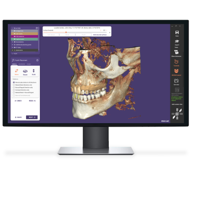 Exocad DentalCAD [Flex] [Standalone]
